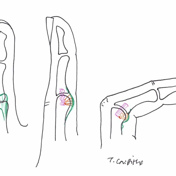 Collateral ligaments 600x600