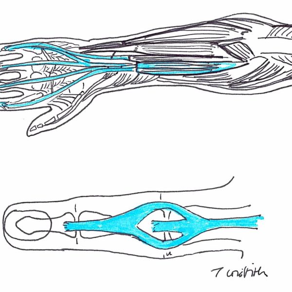 Extensor Tendon 600x600