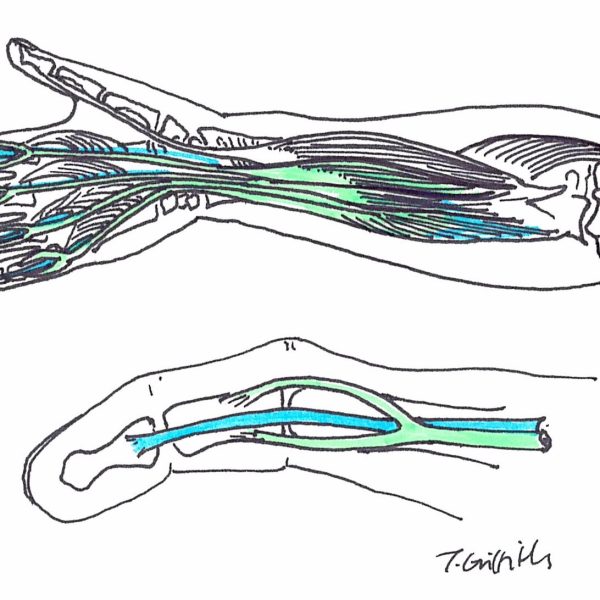 Flexor tendon 600x600